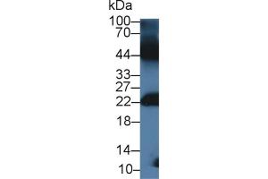 Detection of GREM1 in Mouse Testis lysate using Polyclonal Antibody to Gremlin 1 (GREM1) (GREM1 antibody  (AA 27-184))