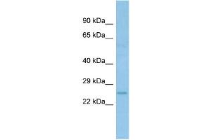 Host: Rabbit Target Name: ACOT6 Sample Type: Fetal Lung lysates Antibody Dilution: 1. (ACOT6 antibody  (C-Term))