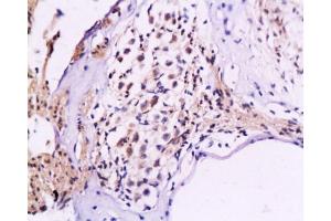 Formalin-fixed and paraffin embedded rat cochlea tissue labeled Anti-NF-M/Neurofilament M Polyclonal Antibody, Unconjugated  at 1:200, followed by conjugation to the secondary antibody and DAB staining (NEFM antibody  (AA 101-200))