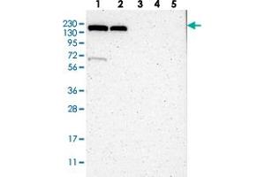 Western blot analysis of Lane 1: RT-4, Lane 2: U-251 MG, Lane 3: Human Plasma, Lane 4: Liver, Lane 5: Tonsil with KIAA0355 polyclonal antibody  at 1:250-1:500 dilution. (KIAA0355 antibody)