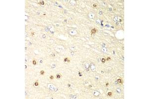 Immunohistochemistry of paraffin-embedded rat brain using HIF1AN antibody (ABIN5973179) at dilution of 1/100 (40x lens). (HIF1AN antibody)