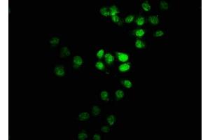 Immunofluorescence staining of Hela cells with ABIN7171492 at 1:100, counter-stained with DAPI. (TBKBP1 antibody  (AA 327-427))
