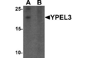 Western blot analysis of YPEL3 in A-20 cell lysate with YPEL3 antibody at 1 µg/mL in (A) the absence and (B) the presence of blocking peptide (YPEL3 antibody  (N-Term))