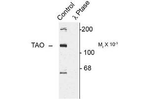Image no. 1 for anti-TAO Kinase 2 (TAOK2) (pSer181) antibody (ABIN372726) (TAO Kinase 2 antibody  (pSer181))