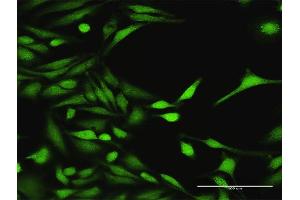 Immunofluorescence of purified MaxPab antibody to MAP3K7 on HeLa cell. (MAP3K7 antibody  (AA 1-579))