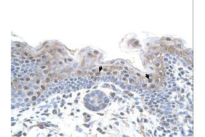 Immunohistochemistry (IHC) image for anti-Serine/threonine Kinase Receptor Associated Protein (STRAP) (C-Term) antibody (ABIN2783201) (STRAP antibody  (C-Term))
