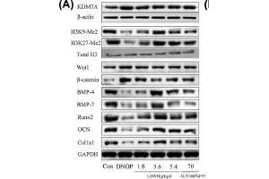 Effect of LWDH on KDM7A, Wnt1/β-catenin signaling, and osteoblast differentiation-related proteins expression of the femur tissue in DNOP rats(A and B) Western blot analysis for KDM7A, H3K9-Me2, H3K27-Me2, Wnt1, β-catenin, BMP-4, BMP-7, Runx2, OCN, and Col1a1 expression in the femur tissue of DNOP rats. (Histone 3 antibody  (H3K9me2))
