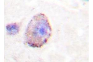 Immunohistochemistry analyzes of PLC β3 antibody in paraffin-embedded human brain tissue. (PLCB3 antibody)