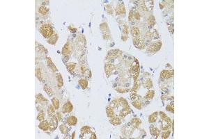 Immunohistochemistry of paraffin-embedded human stomach using HD antibody (ABIN6128012, ABIN6141669, ABIN6141672 and ABIN6213648) at dilution of 1:100 (40x lens). (HDAC4 antibody  (AA 451-650))