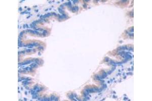 Figure. (CTLA4 antibody  (AA 41-192))