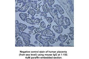 Image no. 2 for anti-Hypoxia Inducible Factor 1, alpha Subunit (Basic Helix-Loop-Helix Transcription Factor) (HIF1A) (AA 329-530) antibody (ABIN363210) (HIF1A antibody  (AA 329-530))