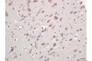Formalin-fixed and paraffin embedded rat brain labeled with Rabbit Anti-ANKRD9 Polyclonal Antibody, Unconjugated (ABIN2170251) at 1:200 followed by conjugation to the secondary antibody and DAB staining (ANKRD9 antibody  (AA 21-200))