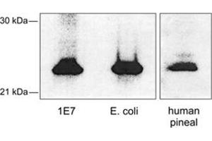 Western blot analysis of AANAT using AANAT polyclonal antibody .