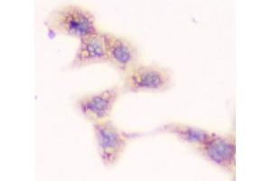 ICC testing of FFPE human A431 cells with SMN1/2 antibody. (SMN1 / SMN2 antibody)