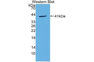 Western blot analysis of the recombinant protein. (CCL20 antibody  (AA 24-95))