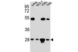 Western Blotting (WB) image for anti-Transcription Factor A, Mitochondrial (TFAM) antibody (ABIN5015230) (TFAM antibody)
