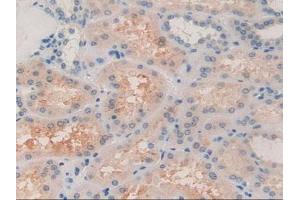 Immunohistochemistry (IHC) image for anti-alpha-2-Glycoprotein 1, Zinc-Binding (AZGP1) (AA 180-298) antibody (ABIN7430039)