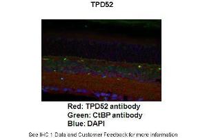Application: ImmunofluorescenceSpecies+tissue/cell type: Mouse retina Primary Antibody dilution: 1:200Secondary Antibody: Goat anti-rabbit Alexafluor 568 Secondary Antibody Dilution: 1:000 (TPD52 antibody  (C-Term))