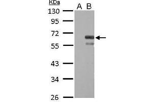 WB Image Factor X antibody detects F10 protein by Western blot analysis. (Coagulation Factor X antibody)