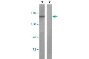 Western blot analysis of Lane 1: HepG2 cells, Lane 2: antigen-specific peptide treated HepG2 cells with BLM (phospho T99) polyclonal antibody  at 1:500-1:1000 dilution. (BLM antibody  (pThr99))