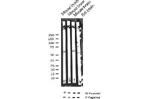 Western blot analysis of Phospho-Synaptotagmin (Thr202) expression in various lysates (Synaptotagmin antibody  (pThr202))