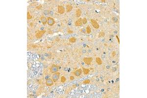 Immunohistochemistry of paraffin embedded rat brain using SLC7A14 (ABIN7075683) at dilution of 1:700 (400x lens) (SLC7A14 antibody)
