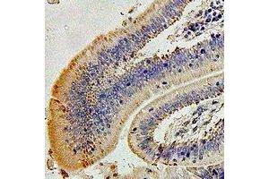 Immunohistochemistry (IHC) image for anti-Crystallin, alpha A (CRYAA) antibody (ABIN7307692)