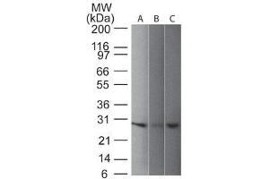 Western blot of UchL1 (PGP9. (UCHL1 antibody)