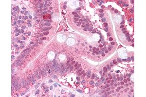 Immunohistochemistry (IHC) image for anti-Mitogen-Activated Protein Kinase Kinase 2 (MAP2K2) (N-Term) antibody (ABIN2783572) (MEK2 antibody  (N-Term))