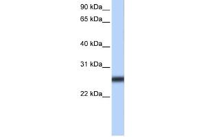 WB Suggested Anti-TMPRSS5 Antibody Titration:  0. (TMPRSS5 antibody  (Middle Region))