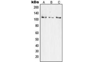 Western blot analysis of JIK expression in HeLa (A), Jurkat (B), HEK293 (C) whole cell lysates. (TAO Kinase 3 antibody  (Center))