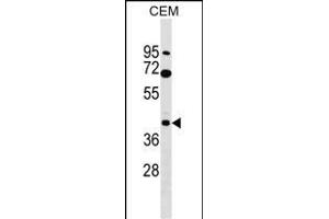 CACNG3 Antibody (N-term) (ABIN1539258 and ABIN2849710) western blot analysis in CEM cell line lysates (35 μg/lane). (CACNG3 antibody  (N-Term))