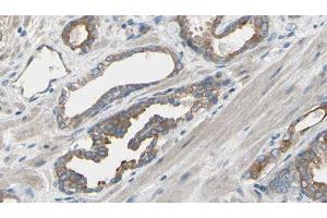 ABIN6277567 at 1/100 staining Human prostate tissue by IHC-P. (EIF4B antibody  (Internal Region))
