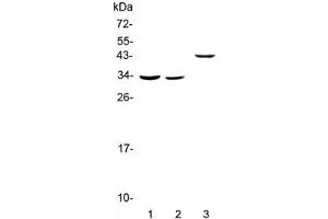 Western blot testing of 1) rat liver, 2) mouse liver and 3) human SMMC-7721 lysate with Regucalcin antibody at 0. (Regucalcin antibody)