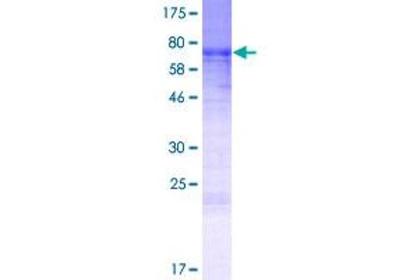 MURC Protein (AA 1-364) (GST tag)