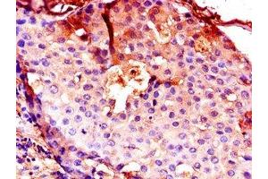 Immunohistochemistry (IHC) image for anti-Cathepsin B (CTSB) (AA 82-333) antibody (ABIN7146996)