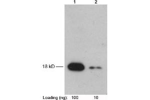 Lane 1-2: Recombinant Trx-tag fusion protein in E.