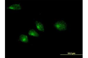 Immunofluorescence of purified MaxPab antibody to GOSR2 on HeLa cell. (GOSR2 antibody  (AA 1-213))