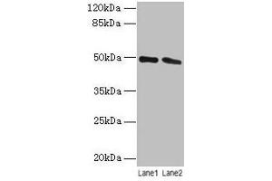 Western blot All lanes: STAMBP antibody at 12 μg/mL Lane 1: Jurkat whole cell lysate Lane 2: Hela whole cell lysate Secondary Goat polyclonal to rabbit IgG at 1/10000 dilution Predicted band size: 49, 40 kDa Observed band size: 49 kDa (STAMBP antibody  (AA 1-424))