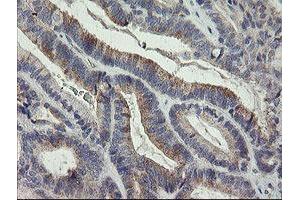 Image no. 1 for anti-Leucine Proline-Enriched Proteoglycan (Leprecan) 1 (LEPRE1) antibody (ABIN1499129) (LEPRE1 antibody)