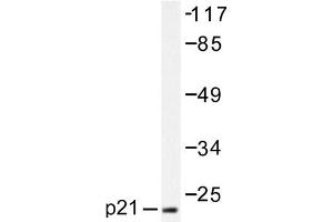 Image no. 1 for anti-Cyclin-Dependent Kinase Inhibitor 1A (p21, Cip1) (CDKN1A) antibody (ABIN271762)