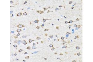 Immunohistochemistry of paraffin-embedded Rat brain using COPB2 Polyclonal Antibody at dilution of 1:100 (40x lens). (COPB2 antibody)