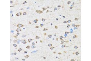 Immunohistochemistry of paraffin-embedded Rat brain using COPB2 Polyclonal Antibody at dilution of 1:100 (40x lens).