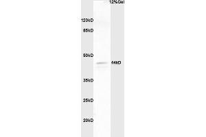 Lane 1: human colon carcinoma lysates probed with Anti phospho-ERK1/2(Thr202 + Tyr204) Polyclonal Antibody, Unconjugated (ABIN682933) at 1:200 in 4 °C. (ERK1/2 antibody  (pThr202, pTyr204))