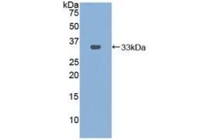 Detection of Recombinant PDXK, Mouse using Polyclonal Antibody to Pyridoxal Kinase (PDXK) (PDXK antibody  (AA 29-285))