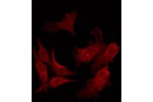 OR10A4 antibody  (C-Term)