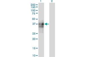 Western Blot analysis of SPARC expression in transfected 293T cell line by SPARC monoclonal antibody (M04A), clone 1A2.