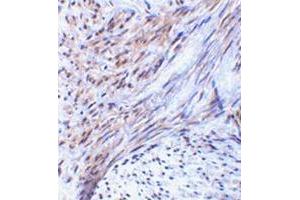 Immunohistochemistry of TRIM5 alpha in human uterus tissue with this product at 2 μg/ml.