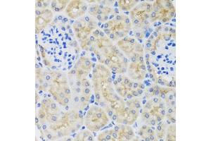 Immunohistochemistry of paraffin-embedded mouse kidney using SULT1A1 antibody (ABIN5970776) at dilution of 1/100 (40x lens).