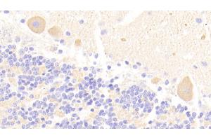 Detection of CHRNa3 in Human Cerebellum Tissue using Polyclonal Antibody to Cholinergic Receptor, Nicotinic, Alpha 3 (CHRNa3) (CHRNA3 antibody  (AA 32-240))